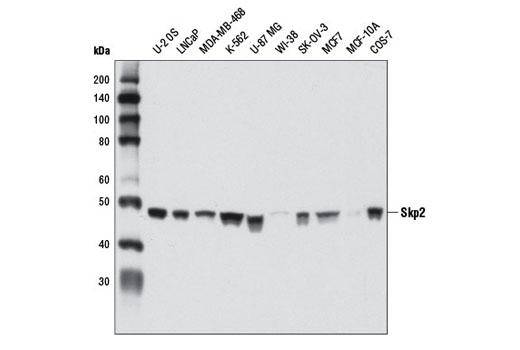  Image 6: Ubiquitin E3 Ligase Complex Antibody Sampler Kit