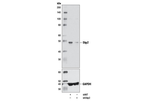  Image 20: Protein Folding and Stability Antibody Sampler Kit