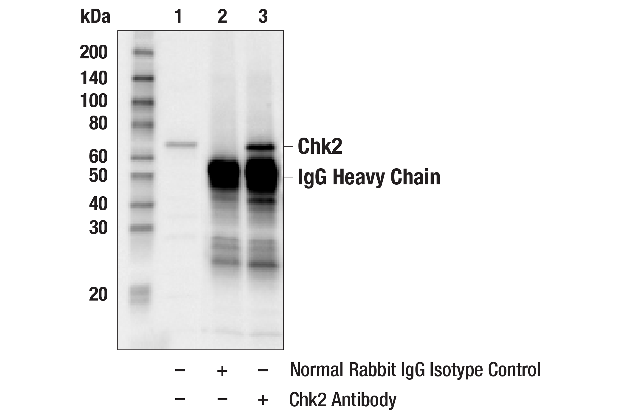 Immunoprecipitation Image 1: Chk2 Antibody