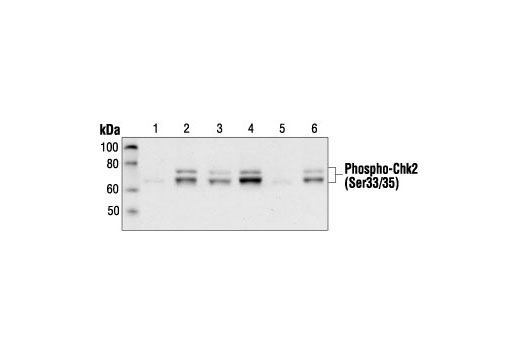  Image 9: Phospho-Chk1/2 Antibody Sampler Kit