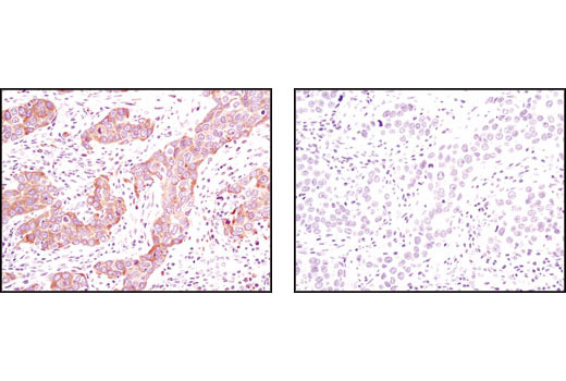  Image 10: ER and Golgi-Associated Marker Proteins Antibody Sampler Kit