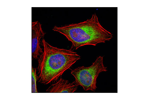  Image 15: ER and Golgi-Associated Marker Proteins Antibody Sampler Kit