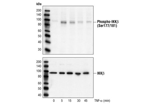 Western Blotting Image 1: Phospho-IKKα/β (Ser176/180) Antibody II