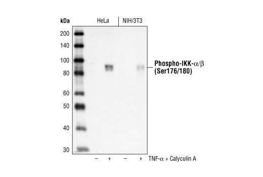  Image 39: NF-κB Pathway Antibody Sampler Kit