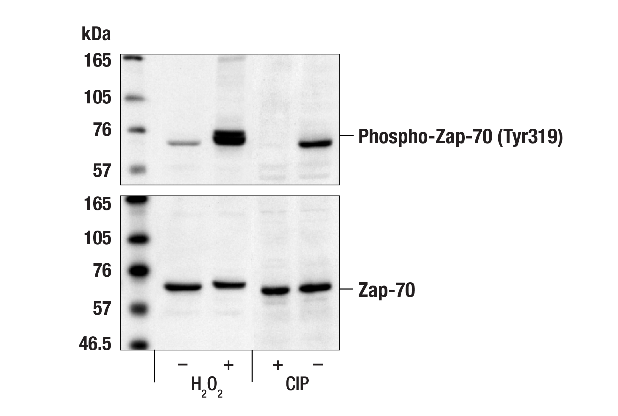 Western Blotting Image 1: Phospho-Zap-70 (Tyr319)/Syk (Tyr352) Antibody