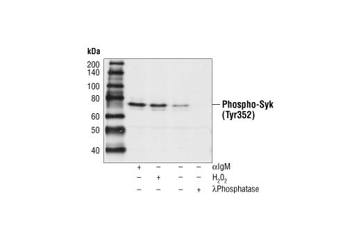 Western Blotting Image 2: Phospho-Zap-70 (Tyr319)/Syk (Tyr352) Antibody
