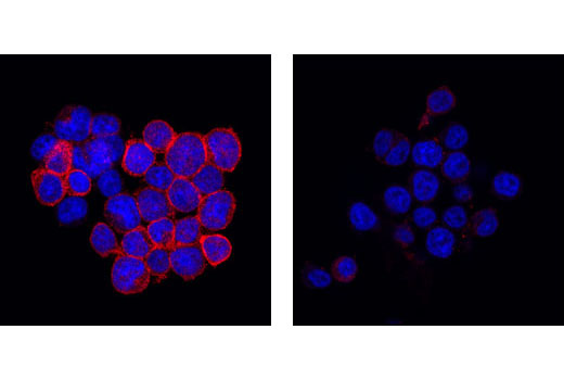 Immunofluorescence Image 1: Phospho-Zap-70 (Tyr319)/Syk (Tyr352) Antibody