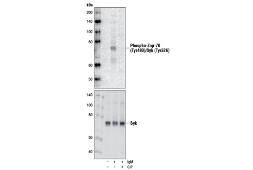 Western Blotting Image 1: Phospho-Zap-70 (Tyr493)/Syk (Tyr526) Antibody