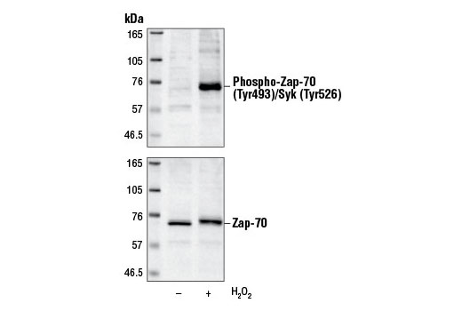 Western Blotting Image 2: Phospho-Zap-70 (Tyr493)/Syk (Tyr526) Antibody