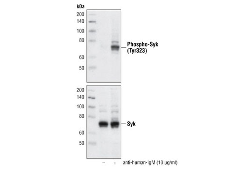  Image 14: Phospho-Syk Antibody Sampler Kit