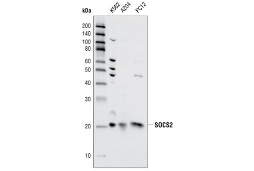  Image 2: Jak/Stat Pathway Inhibitors Antibody Sampler Kit