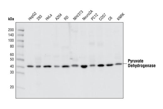 Western Blotting Image 1: Pyruvate Dehydrogenase Antibody