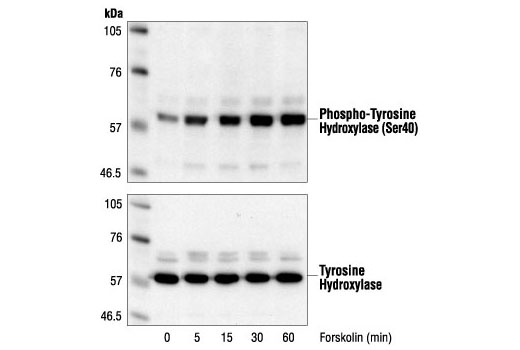 Western Blotting Image 1: Phospho-Tyrosine Hydroxylase (Ser40) Antibody