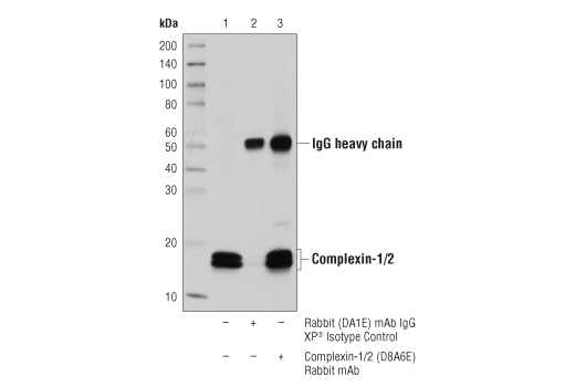 Immunoprecipitation Image 1: Complexin-1/2 (D8A6E) Rabbit mAb