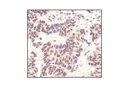  Image 36: Astrocyte Markers Antibody Sampler Kit