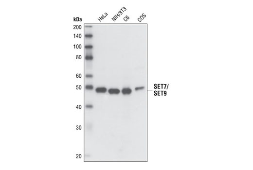 Western Blotting Image 1: SET7/SET9 Antibody