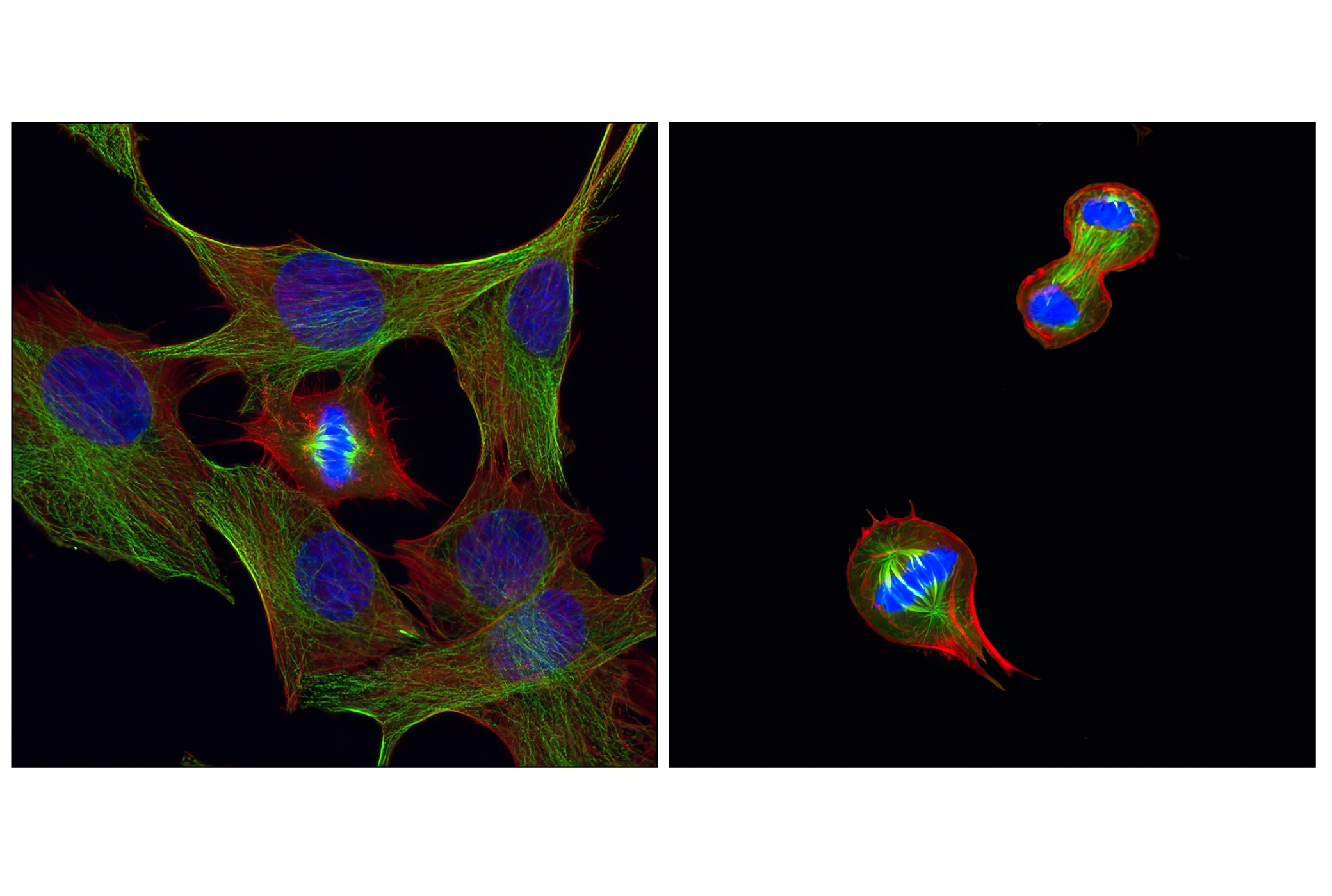 Immunofluorescence Image 1: β-Tubulin (D3U1W) Mouse mAb (BSA and Azide Free)