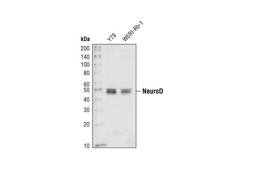 Western Blotting Image 1: NeuroD1 Antibody