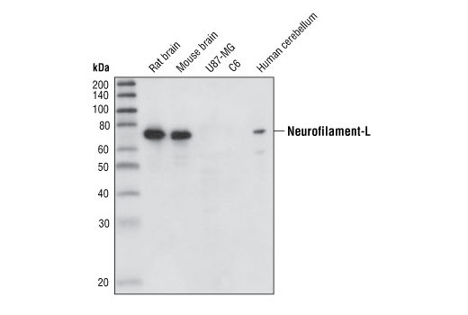  Image 1: Neurofilament Antibody Sampler Kit