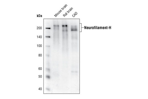 Western Blotting Image 1: Neurofilament-H (RMdO 20) Mouse mAb