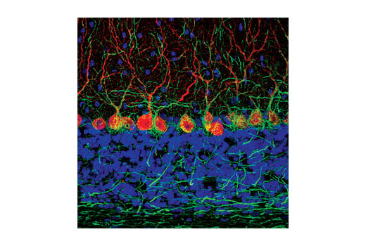 Immunofluorescence Image 1: Neurofilament-H (RMdO 20) Mouse mAb