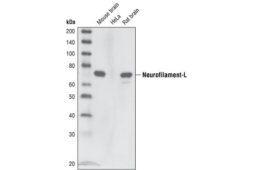  Image 4: Neurofilament Antibody Sampler Kit