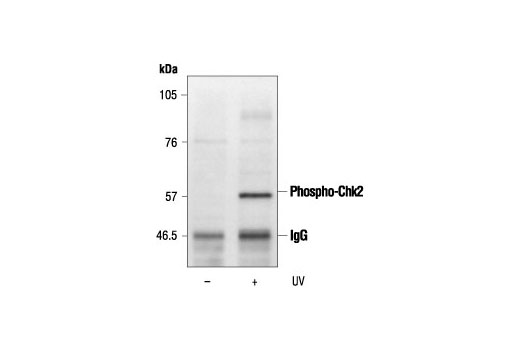 Immunoprecipitation Image 1: Phospho-(Ser/Thr) ATM/ATR Substrate Antibody