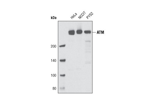  Image 3: PhosphoPlus® ATM (Ser1981) Antibody Duet