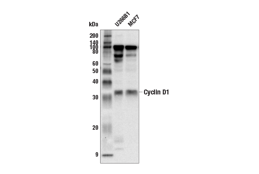 Western Blotting Image 1: Cyclin D1 Antibody
