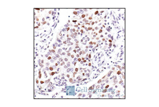  Image 21: Cell Cycle Regulation Antibody Sampler Kit