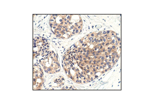  Image 8: PhosphoPlus® mTOR (Ser2448) Antibody Duet