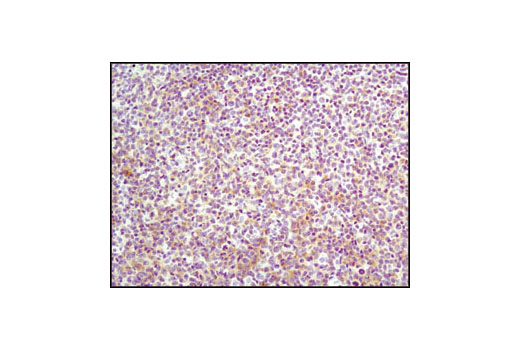 Immunohistochemistry Image 2: Lck (D88) XP® Rabbit mAb