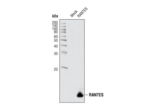 Western Blotting Image 2: CCL5/RANTES (P20) Antibody