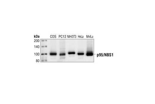 Western Blotting Image 1: p95/NBS1 Antibody