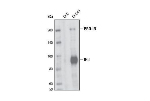 Western Blotting Image 1: Insulin Receptor β (L55B10) Mouse mAb