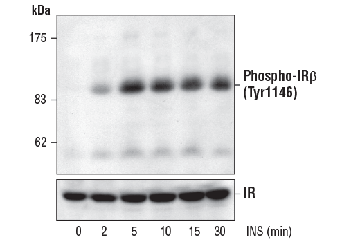  Image 2: Phospho-Insulin/IGF Receptor Antibody Sampler Kit