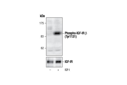  Image 9: Phospho-Insulin/IGF Receptor Antibody Sampler Kit