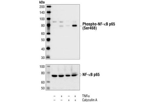 Western Blotting Image 1: Phospho-NF-κB p65 (Ser468) Antibody