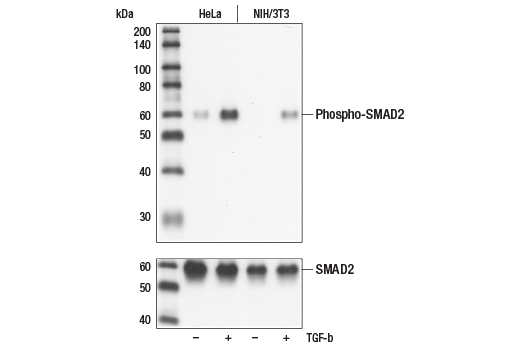  Image 3: SMAD2/3 Antibody Sampler Kit