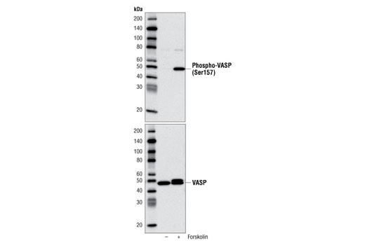 Western Blotting Image 1: Phospho-VASP (Ser157) Antibody