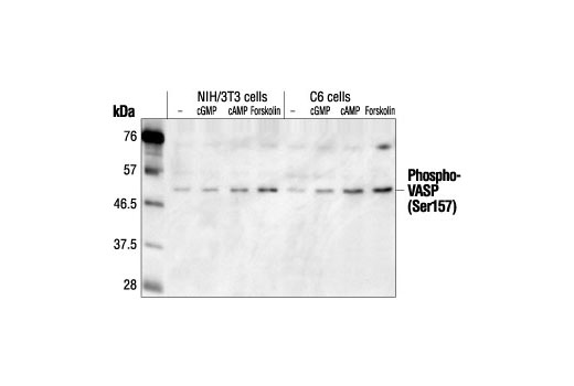 Western Blotting Image 2: Phospho-VASP (Ser157) Antibody