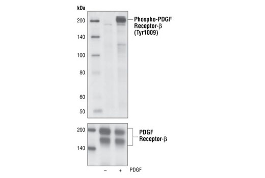 Western Blotting Image 1: Phospho-PDGF Receptor β (Tyr1009) (42F9) Rabbit mAb