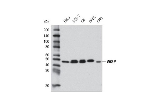 Western Blotting Image 1: VASP (9A2) Rabbit mAb