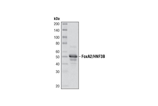 Western Blotting Image 1: FoxA2/HNF3β Antibody
