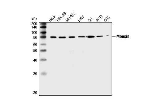 Western Blotting Image 1: Moesin Antibody