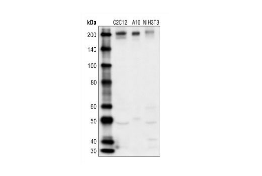 Western Blotting Image 1: PDGF Receptor β Antibody