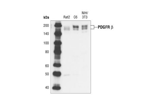  Image 7: PDGF Receptor β Antibody Sampler Kit