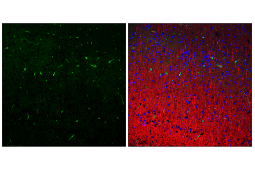 Immunofluorescence Image 2: PDGF Receptor β (28E1) Rabbit mAb