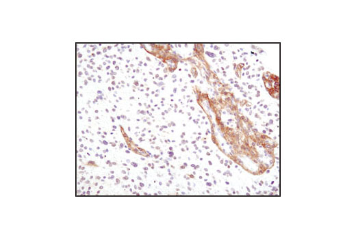  Image 24: Cancer Associated Fibroblast Marker Antibody Sampler Kit