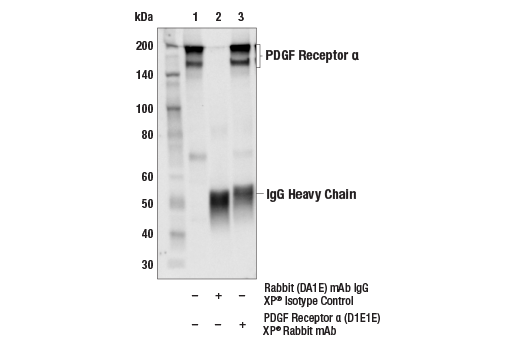  Image 1: PDGF Receptor α Antibody Sampler Kit